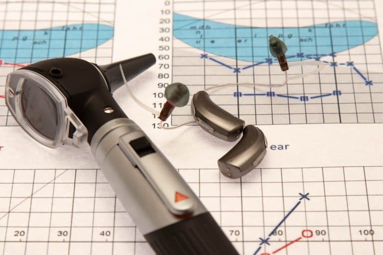 Otoscope and Hearing Aids Close up on a Audiogram Otoscope and Hearing Aids Close up on a Audiogram